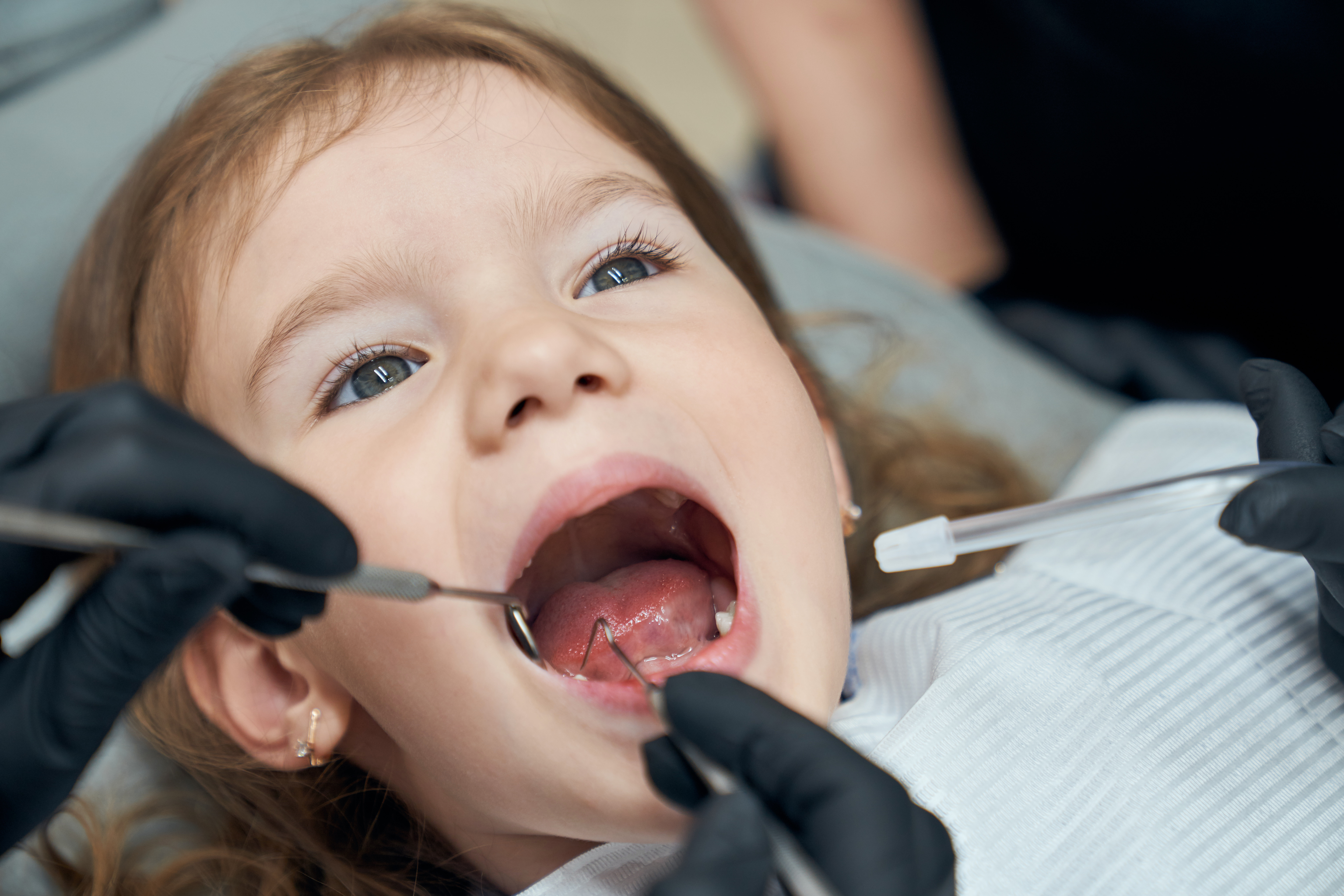 Common Dental Problems in Children & How Parents Can Prevent Them
